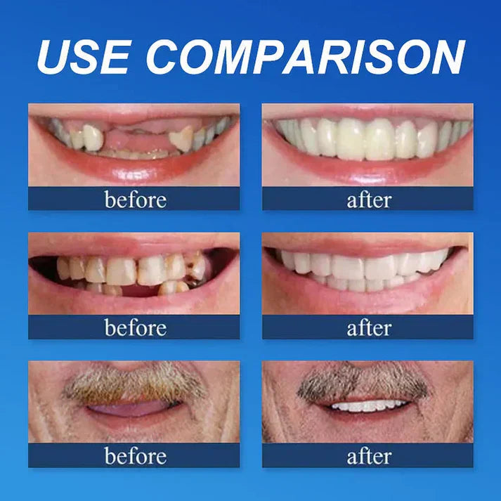 Ends Today: 49% OFF! ⏰ KLENIMORE™ Custom-Fit Smile Support Set — Strong Hold & Natural Look 🦷
